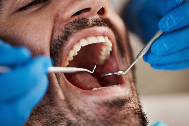 Best Emergency Denture Repair in North Kingsville, OH