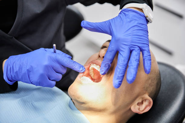 Best Emergency Tooth Extraction in North Kingsville, OH
